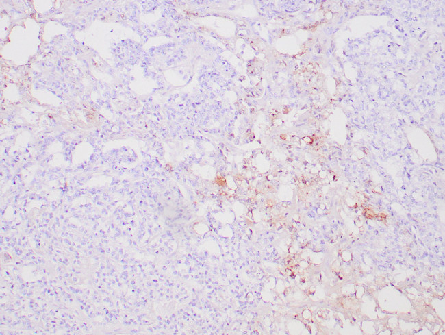 AFP Antibody in Immunohistochemistry (Paraffin) (IHC (P))