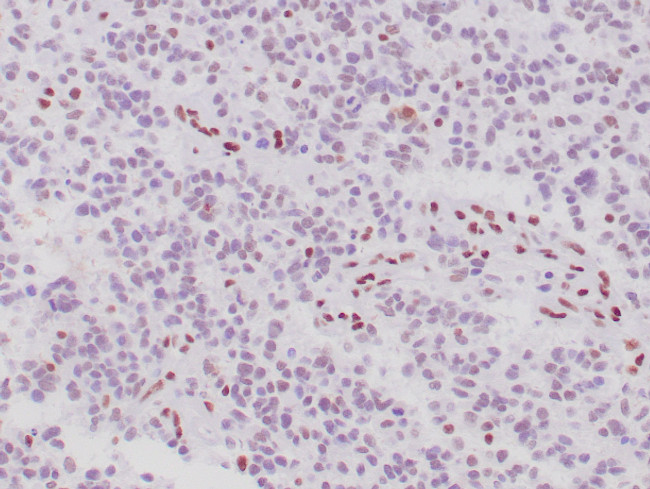 ATRX Antibody in Immunohistochemistry (Paraffin) (IHC (P))