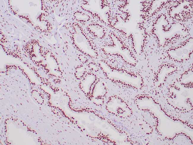 Androgen receptor Antibody in Immunohistochemistry (Paraffin) (IHC (P))