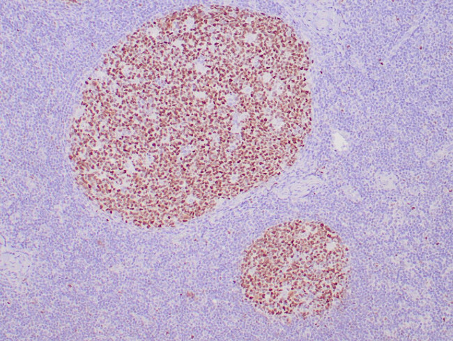 BCL-6 Antibody in Immunohistochemistry (Paraffin) (IHC (P))