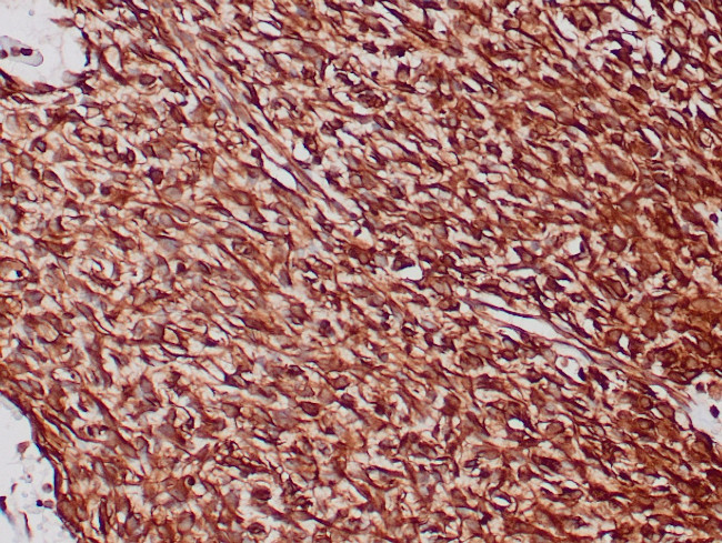 Vimentin Antibody in Immunohistochemistry (Paraffin) (IHC (P))