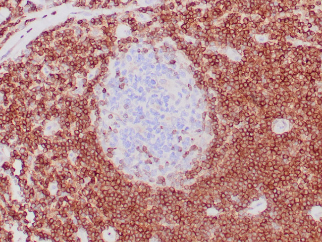 BCL-2 Antibody in Immunohistochemistry (Paraffin) (IHC (P))