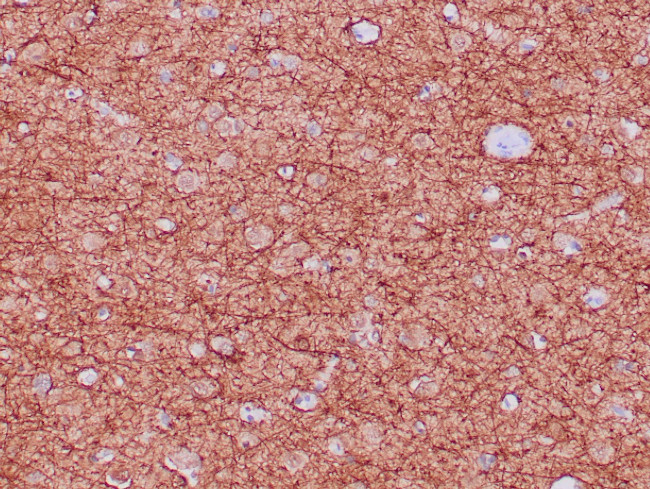 Neurofilament Antibody in Immunohistochemistry (Paraffin) (IHC (P))
