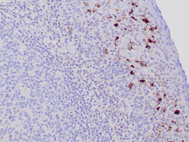 TRAcP Antibody in Immunohistochemistry (Paraffin) (IHC (P))
