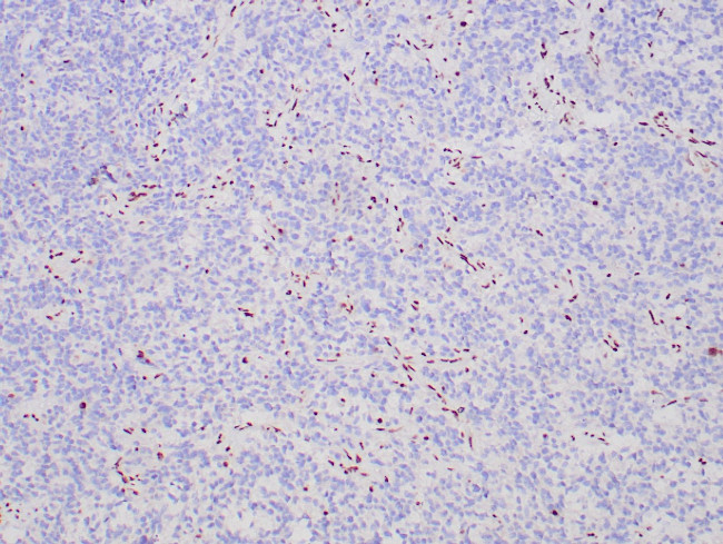 ATRX Antibody in Immunohistochemistry (Paraffin) (IHC (P))