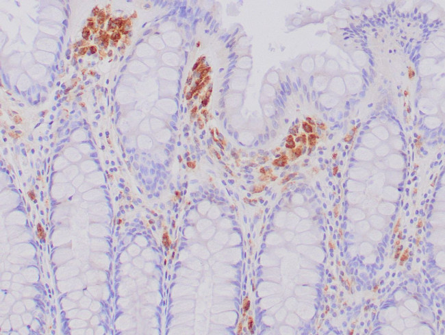 CD68 Antibody in Immunohistochemistry (Paraffin) (IHC (P))