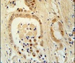 ZNF385B Antibody in Immunohistochemistry (IHC)