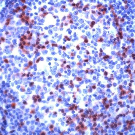 Zap-70 Antibody in Immunohistochemistry (IHC)