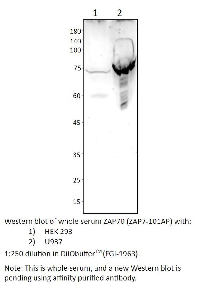 ZAP70 Antibody in Western Blot (WB)