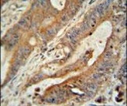 ZBBX Antibody in Immunohistochemistry (IHC)