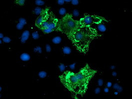 ZBED1 Antibody in Immunocytochemistry (ICC/IF)