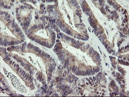 ZBED1 Antibody in Immunohistochemistry (Paraffin) (IHC (P))