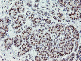 ZBED1 Antibody in Immunohistochemistry (Paraffin) (IHC (P))