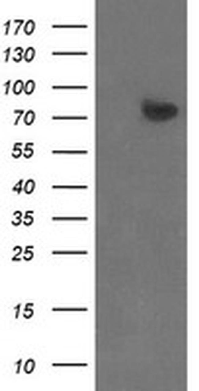 ZBED1 Antibody in Western Blot (WB)