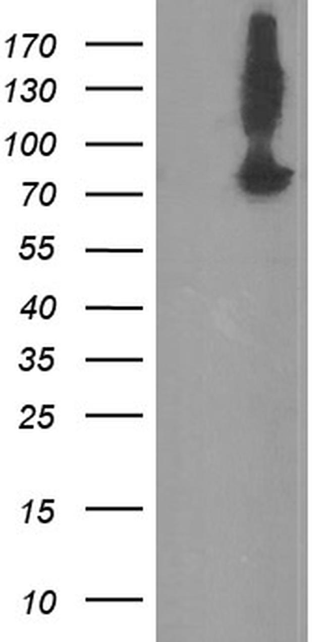 ZBED1 Antibody in Western Blot (WB)