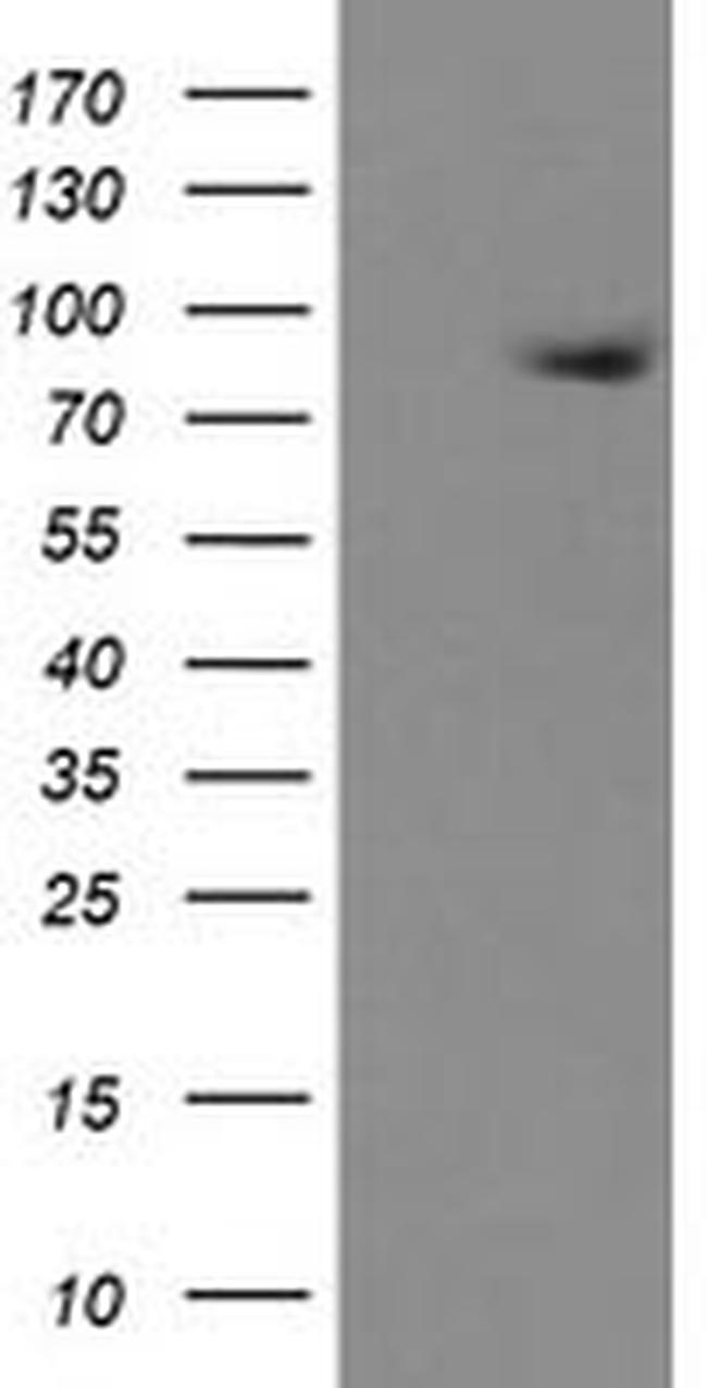 ZBED1 Antibody in Western Blot (WB)