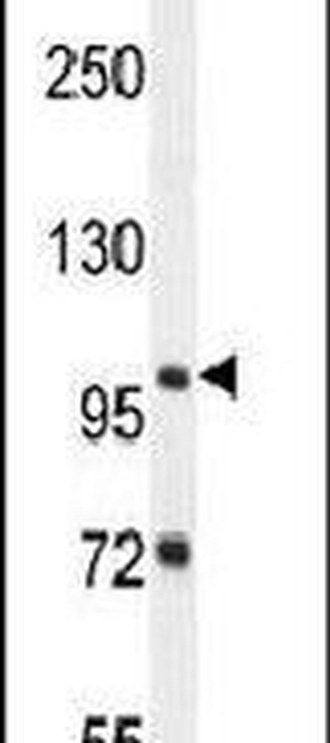 ZBTB10 Antibody in Western Blot (WB)