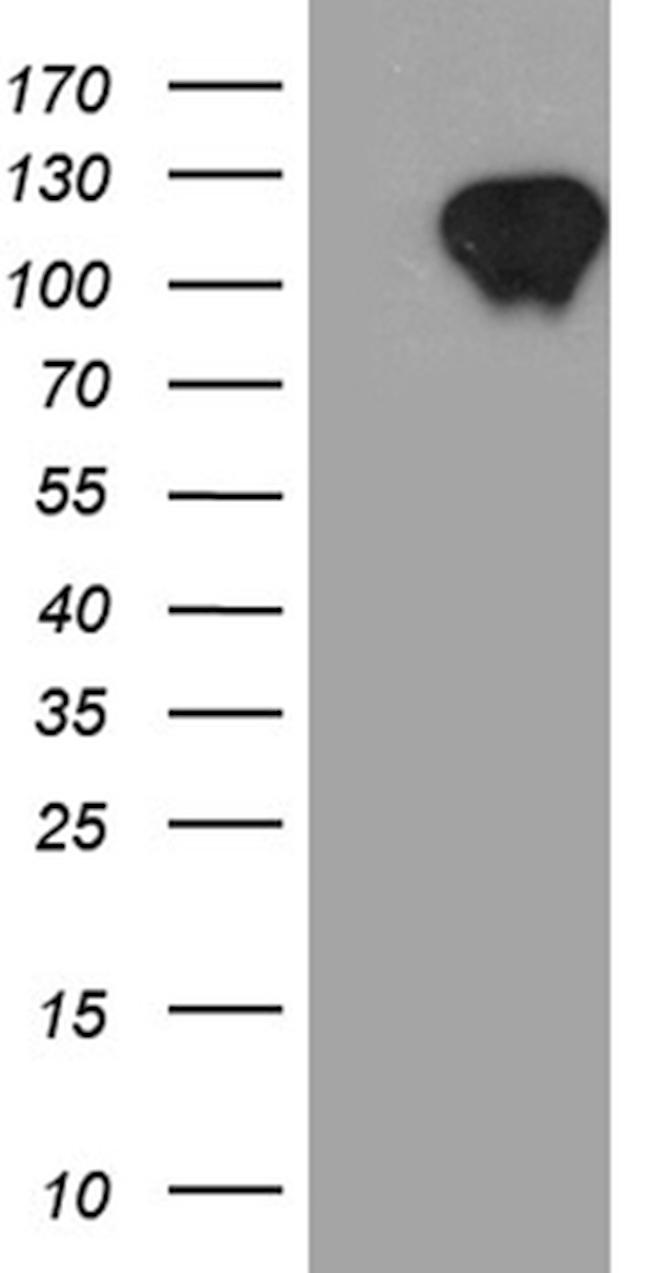 ZBTB17 Antibody in Western Blot (WB)