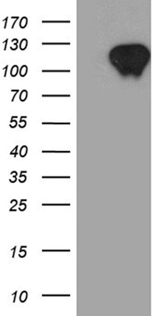 ZBTB17 Antibody in Western Blot (WB)
