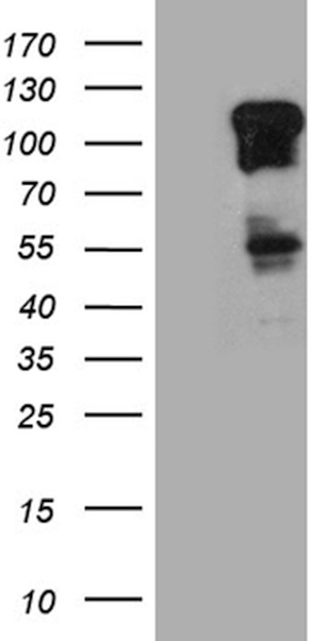 ZBTB17 Antibody in Western Blot (WB)