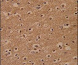 ZBTB2 Antibody in Immunohistochemistry (IHC)