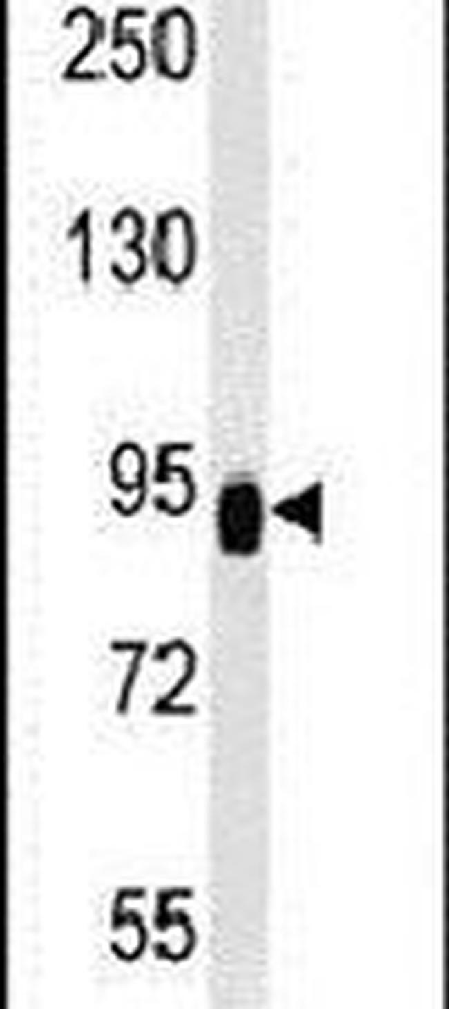 ZBTB41 Antibody in Western Blot (WB)