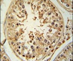 ZBTB5 Antibody in Immunohistochemistry (IHC)