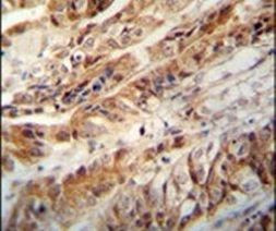 ZC3H15 Antibody in Immunohistochemistry (IHC)