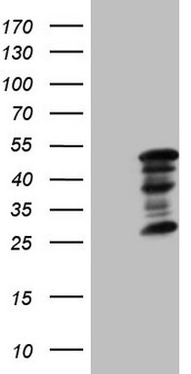 ZC3H8 Antibody in Western Blot (WB)