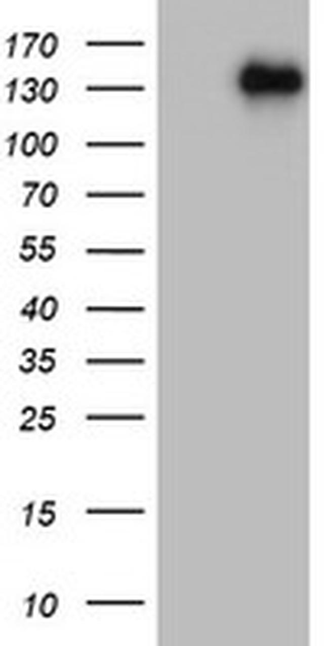 ZEB1 Antibody in Western Blot (WB)