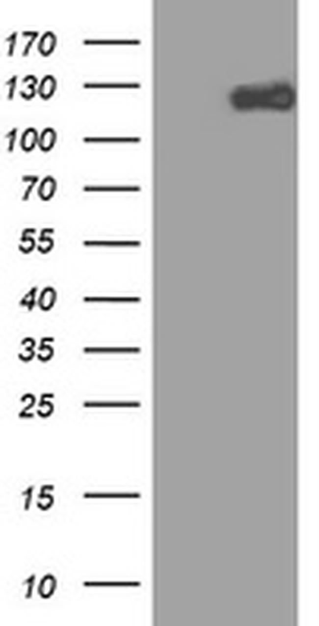 ZEB1 Antibody in Western Blot (WB)