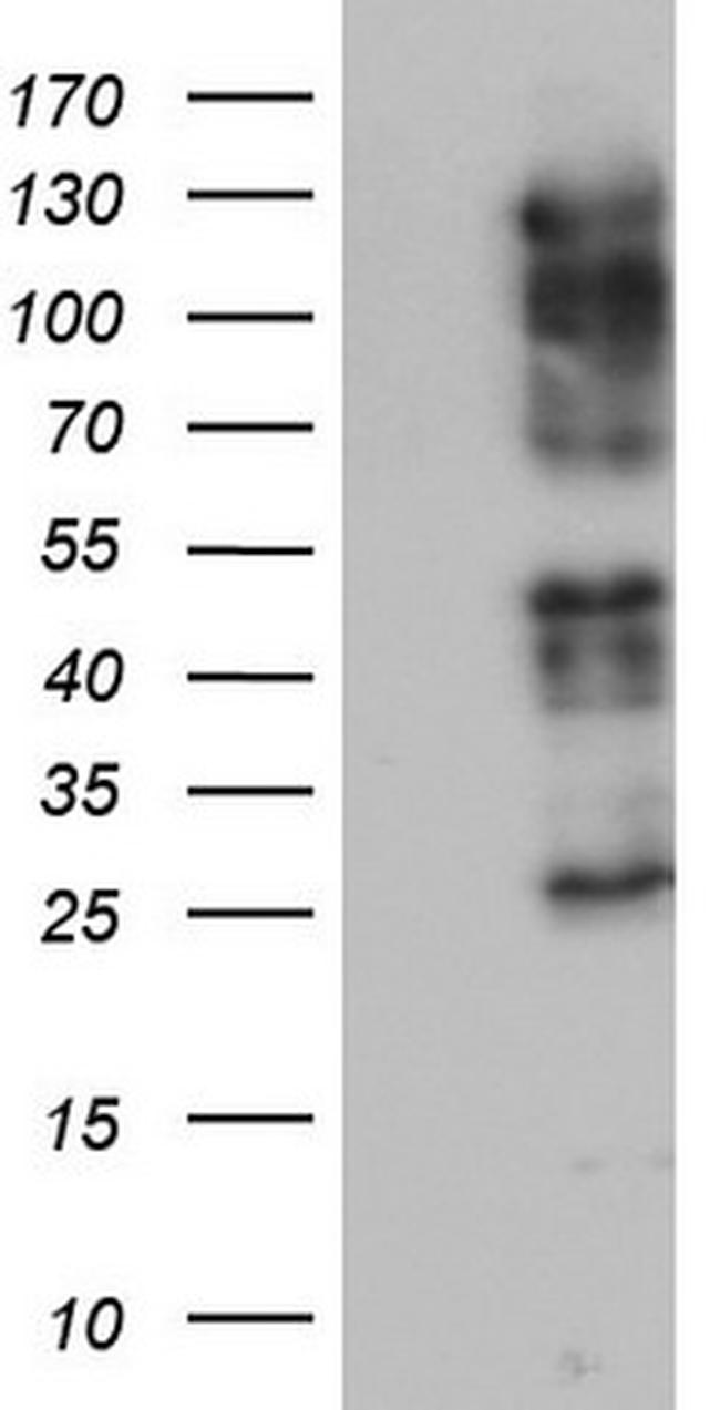 ZEB1 Antibody in Western Blot (WB)