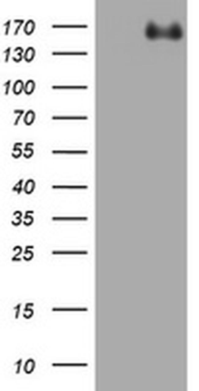 ZEB1 Antibody in Western Blot (WB)