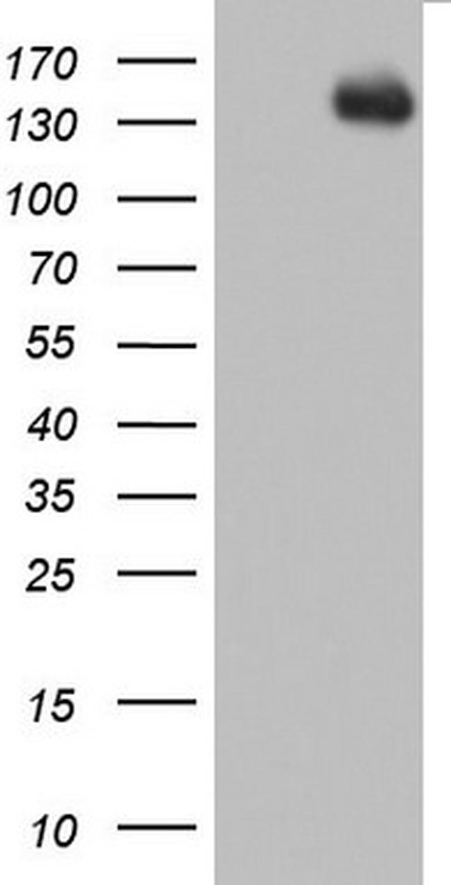 ZEB1 Antibody in Western Blot (WB)