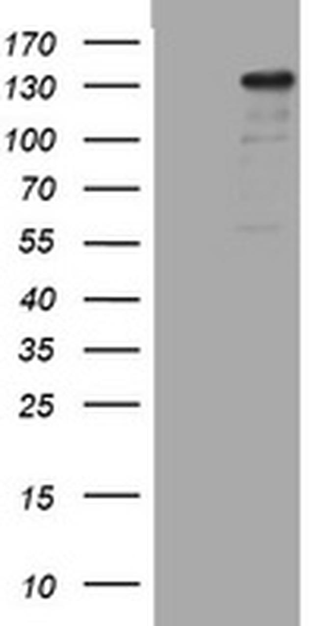 ZEB2 Antibody in Western Blot (WB)
