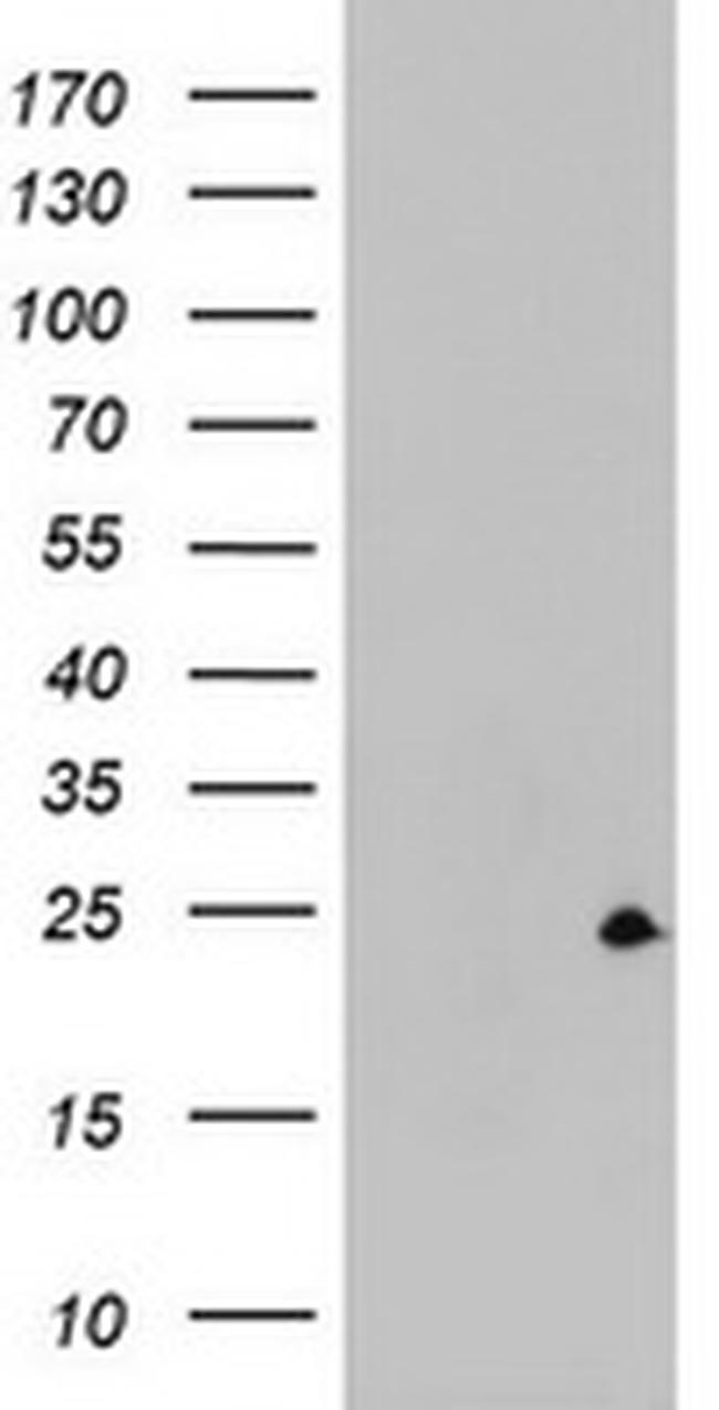 ZFAND5 Antibody in Western Blot (WB)