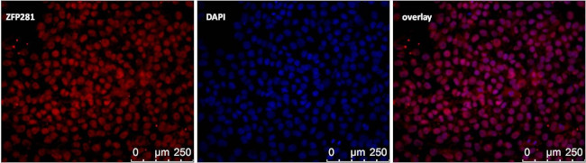 ZNF281 Antibody in Immunocytochemistry (ICC/IF)
