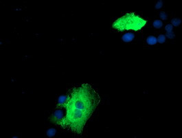 ZFP36 Antibody in Immunocytochemistry (ICC/IF)