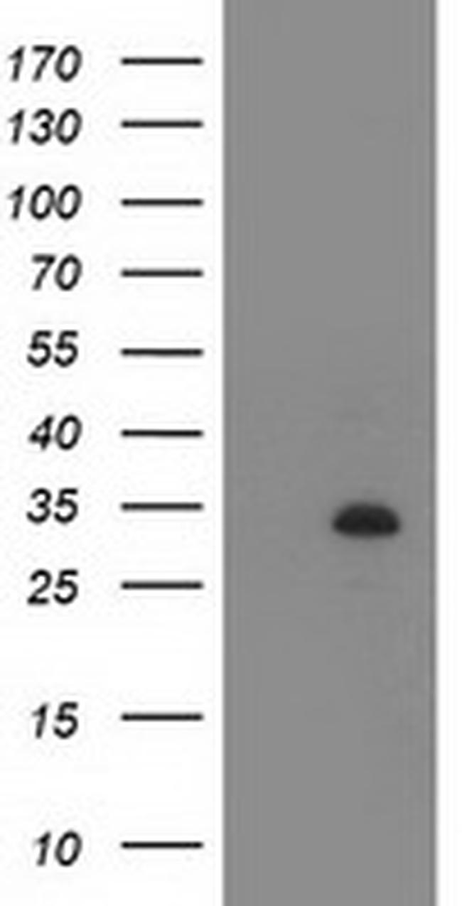 ZFP36 Antibody in Western Blot (WB)