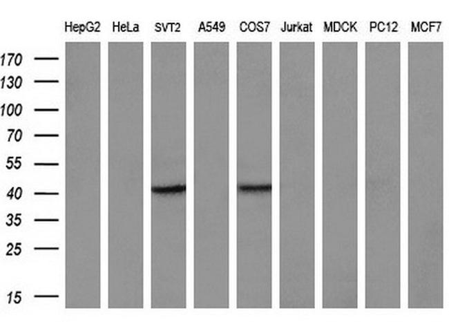 ZFP36 Antibody in Western Blot (WB)