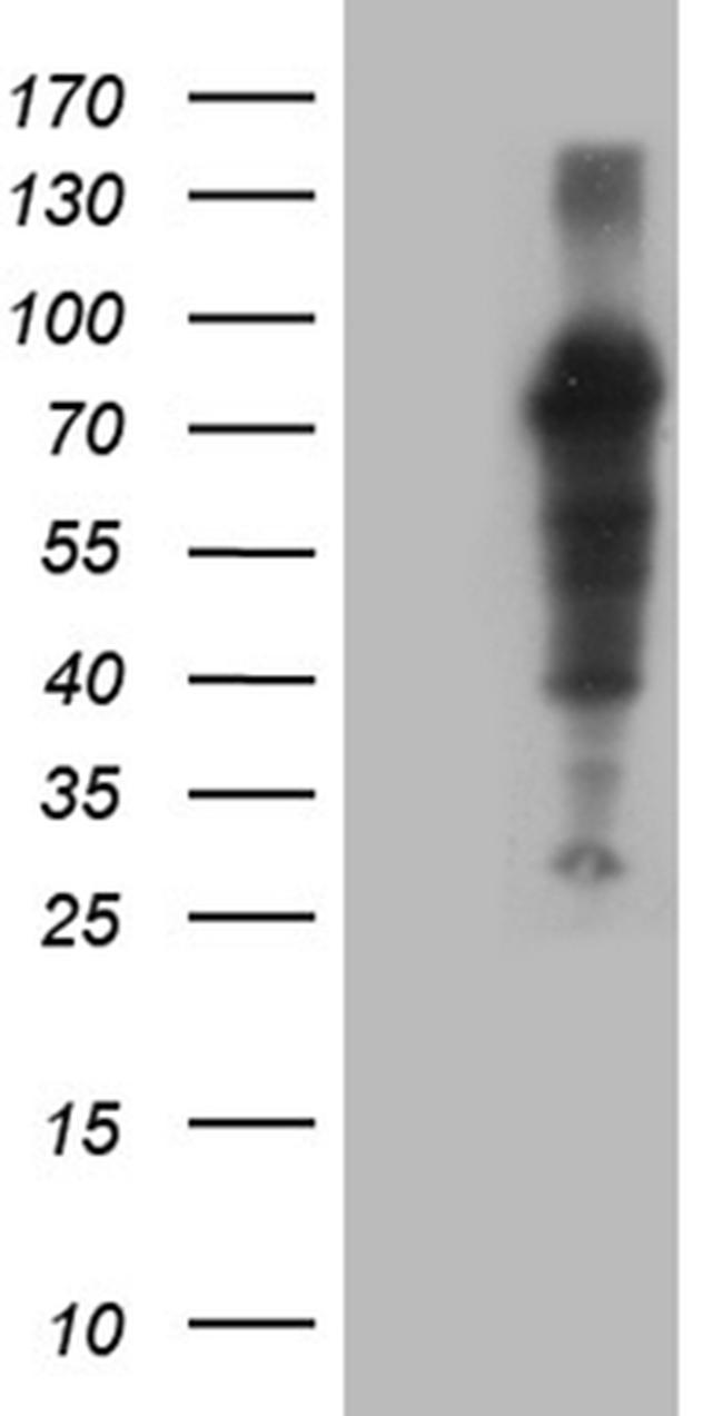 ZFP37 Antibody in Western Blot (WB)