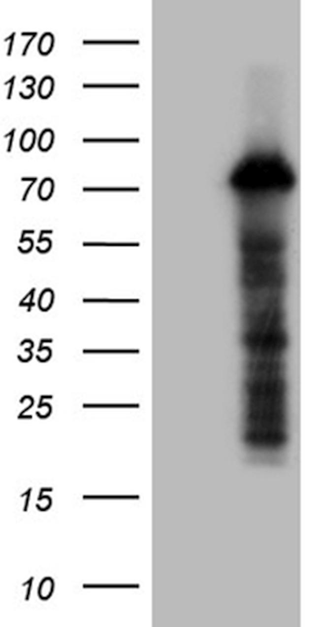 ZFP37 Antibody in Western Blot (WB)