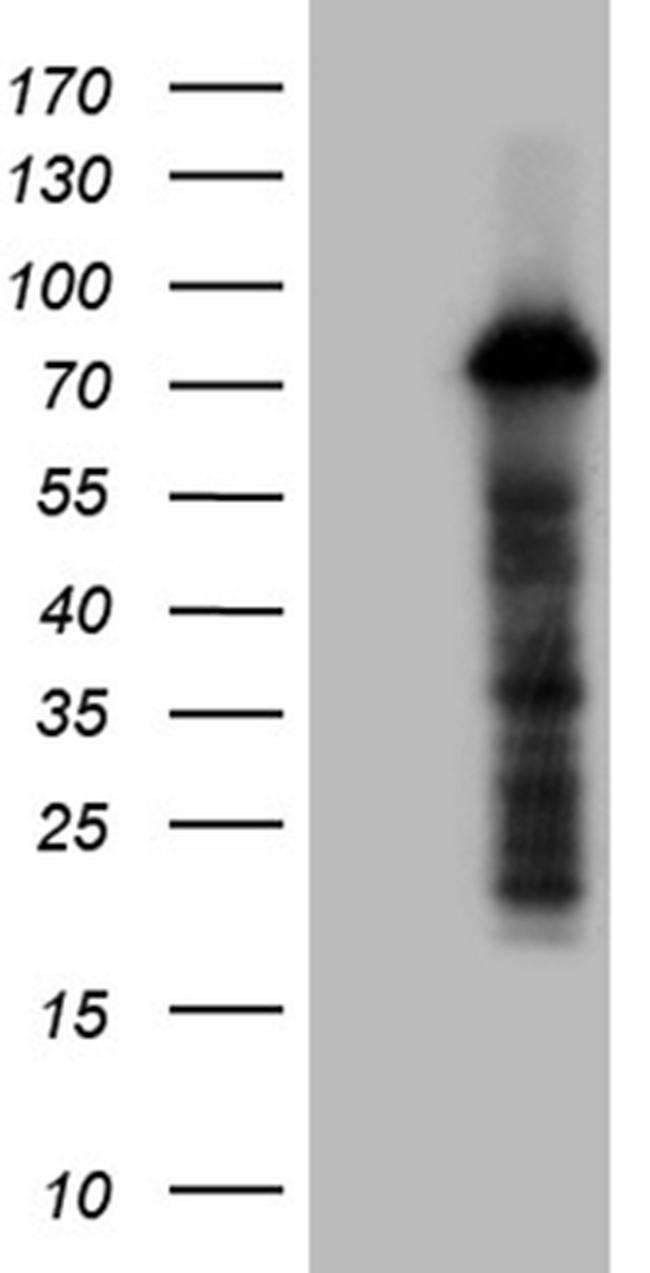 ZFP37 Antibody in Western Blot (WB)