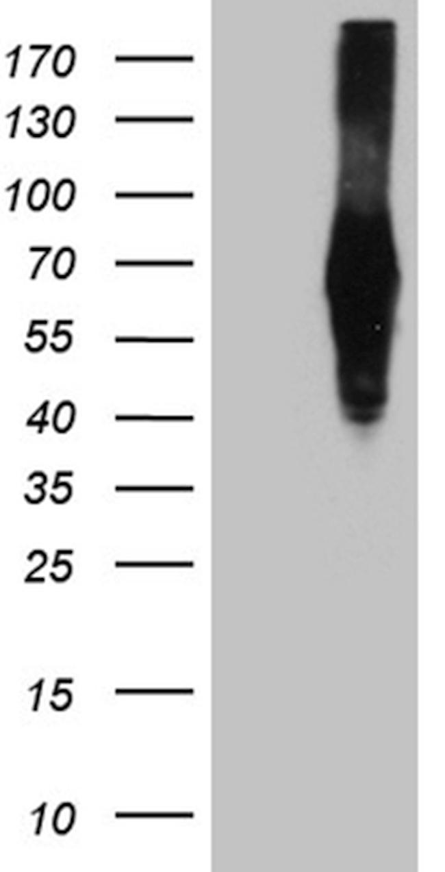 ZFP82 Antibody in Western Blot (WB)