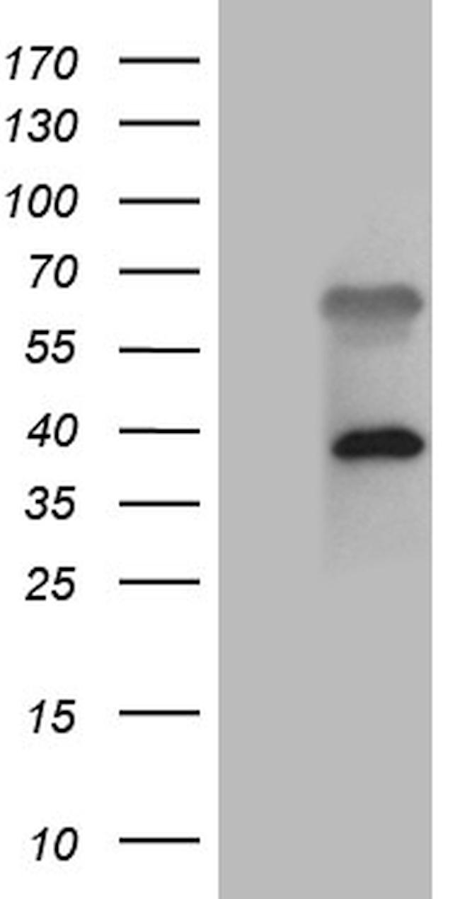 ZFYVE1 Antibody in Western Blot (WB)