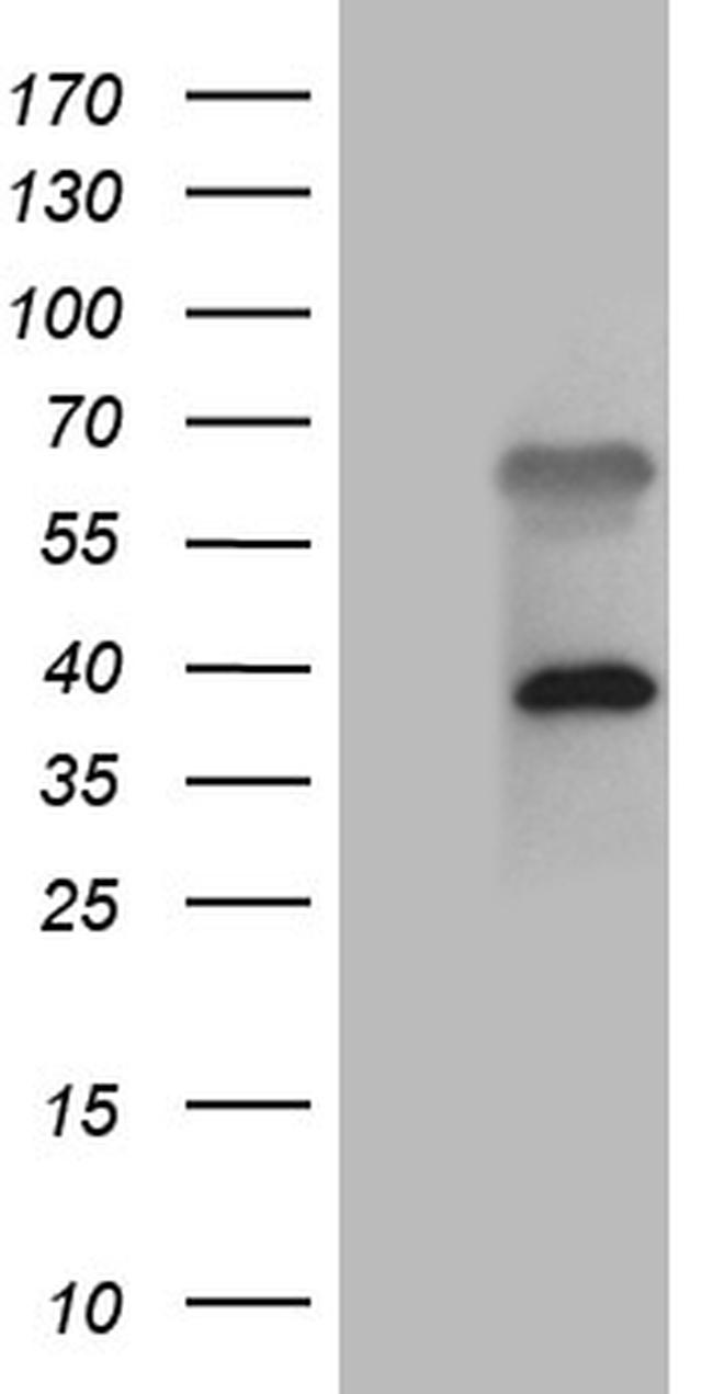 ZFYVE1 Antibody in Western Blot (WB)