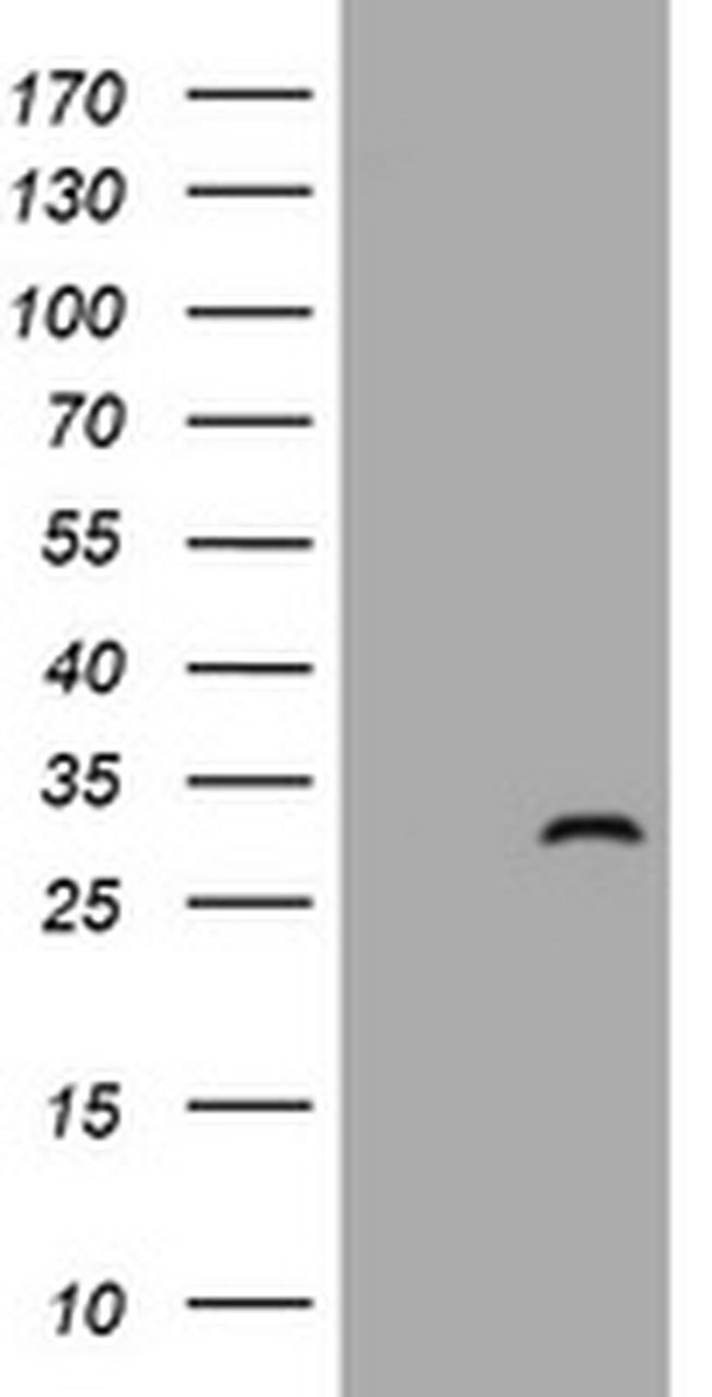 ZFYVE21 Antibody in Western Blot (WB)