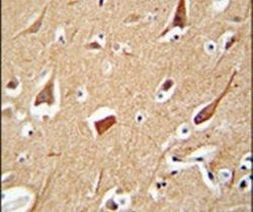 ZFYVE28 Antibody in Immunohistochemistry (IHC)