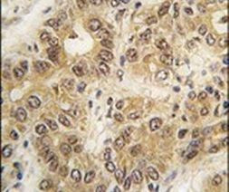 ZIC3 Antibody in Immunohistochemistry (IHC)