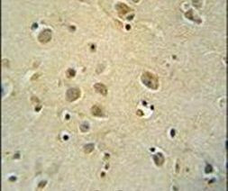 ZIC3 Antibody in Immunohistochemistry (IHC)